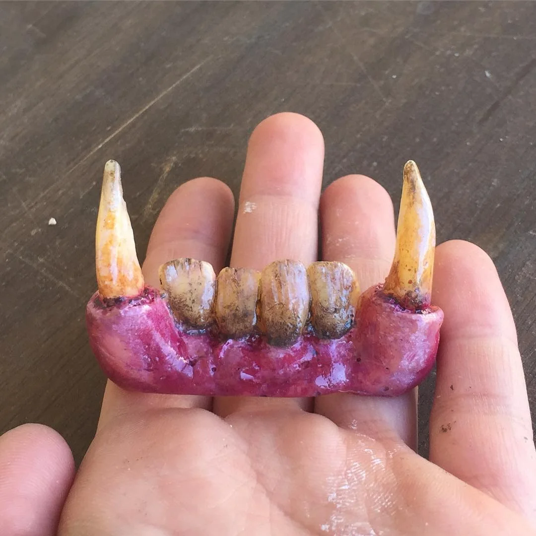 Acrylic Dentures