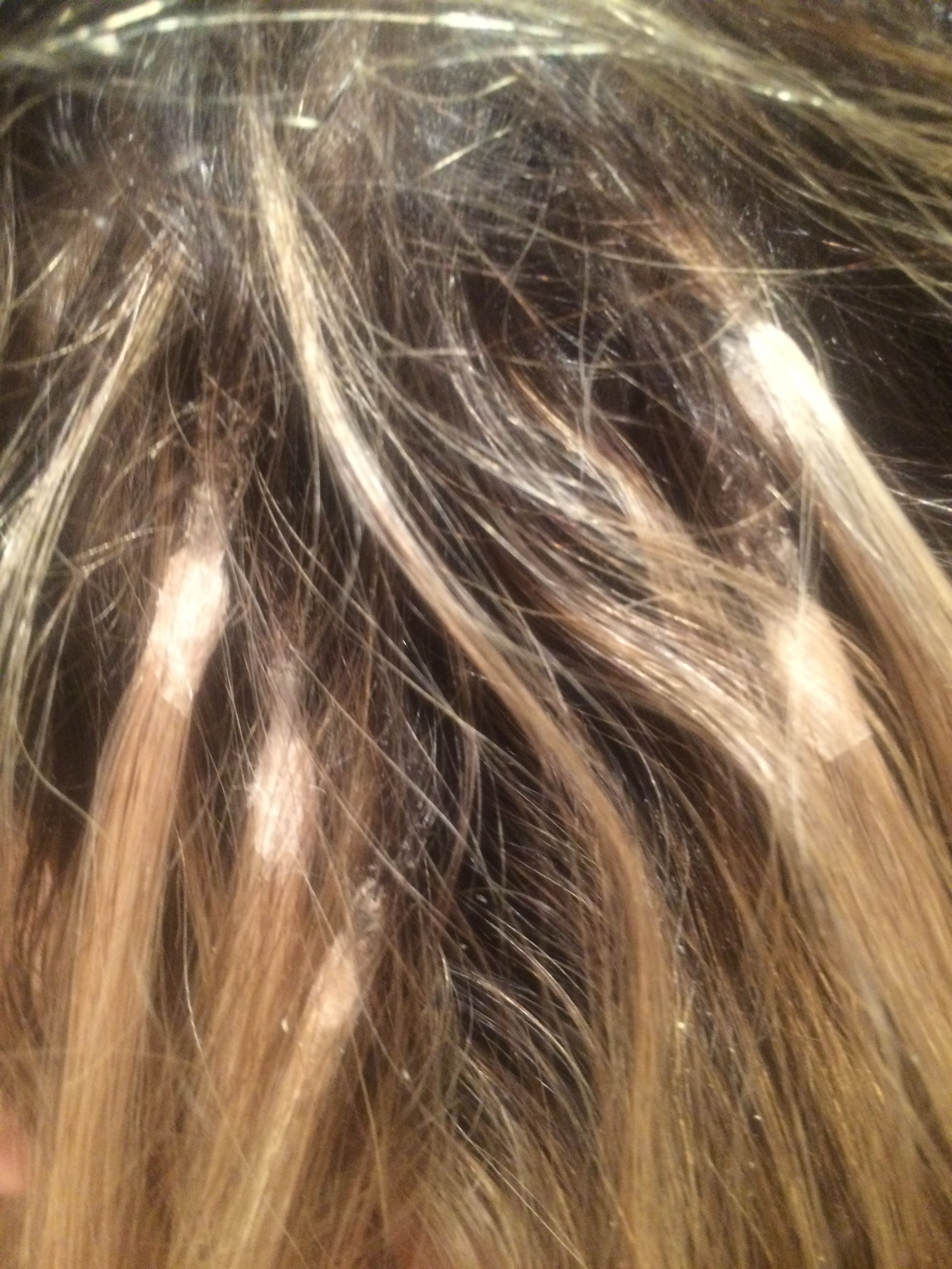 Ugliest photo ever, but why I will never tape in extensions again! These really start to show and look like little larva, plus you feel the extensions pulling out at your scalp and you cant really get to your scalp.&nbsp;&nbsp;
