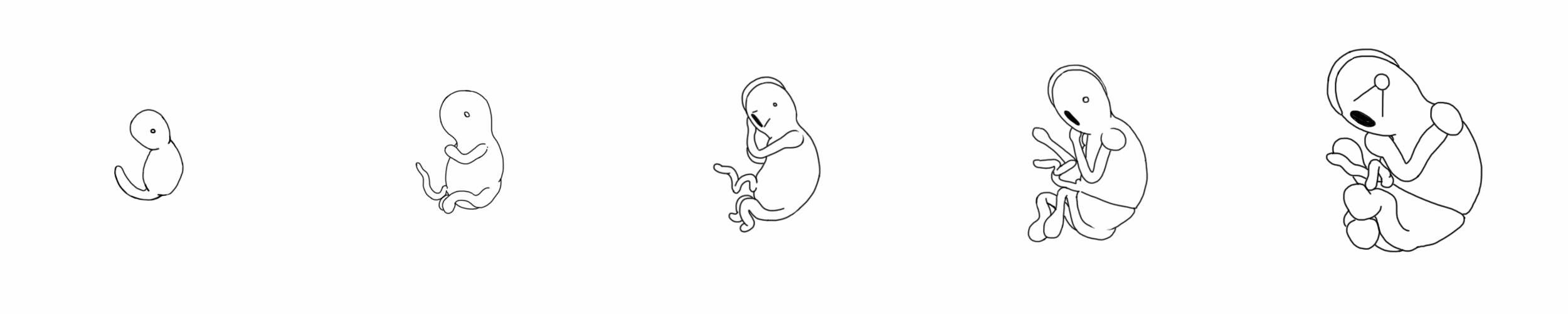 Fetus.gif