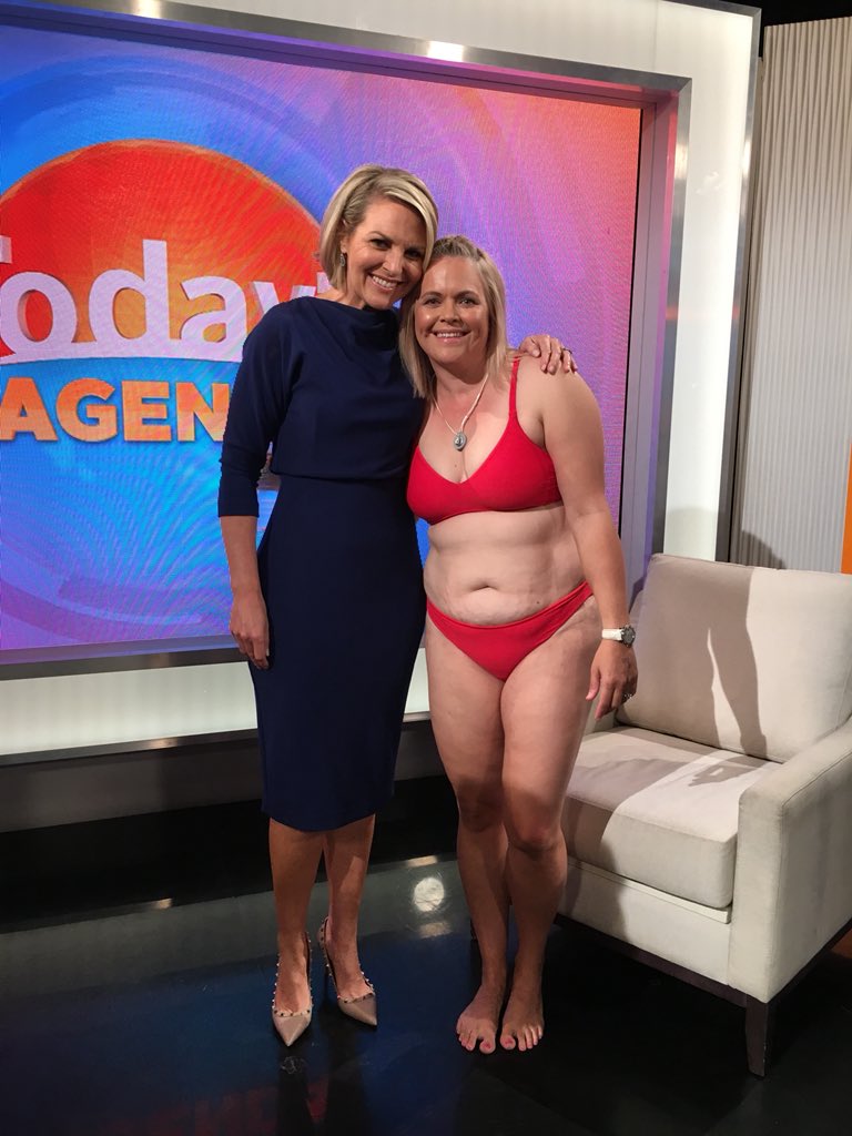   EMBRACE YOU   Body image activist, Taryn Brumfitt, aimed to stop the self loathing many Australian women feel after giving birth. A syndicated opinion piece in News Limited’s mastheads on Mother's Day did the trick. This was followed by an unpreced