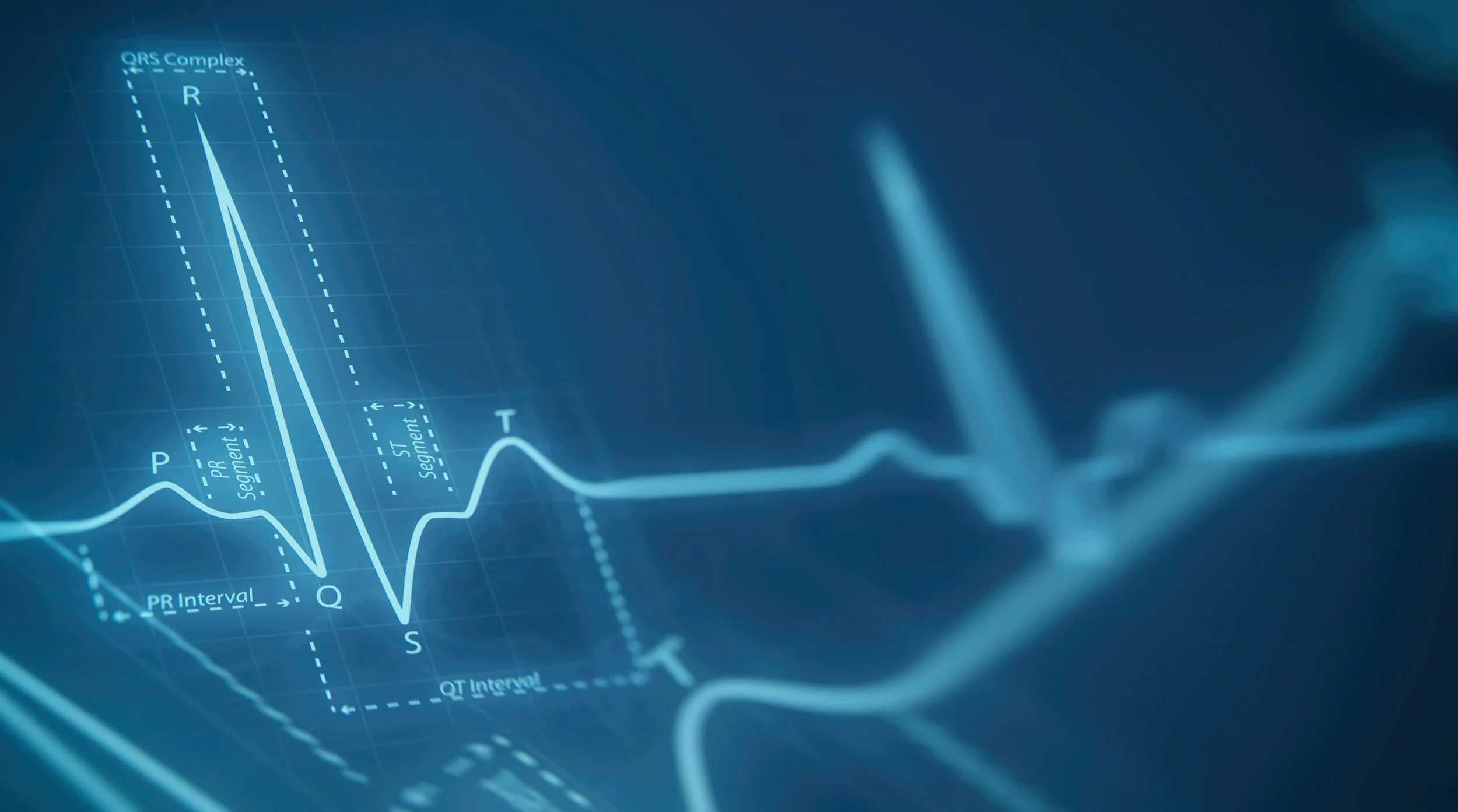ECG_background.jpg