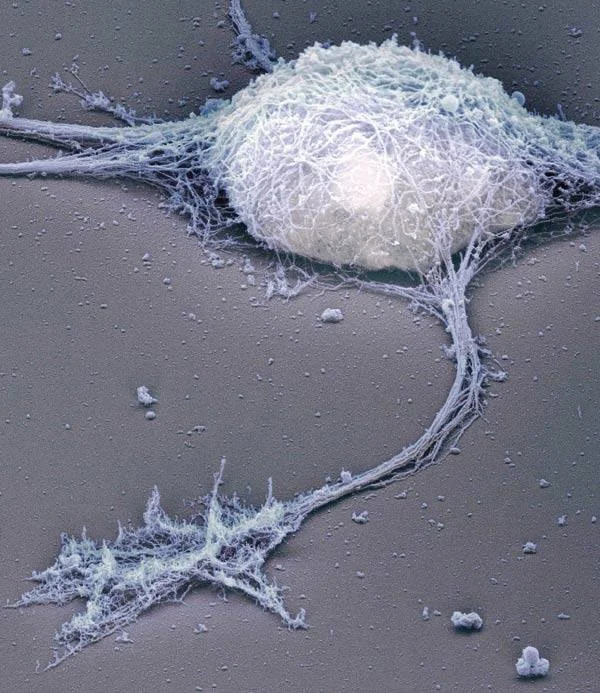 Nerve cell surrounded by fascial tissue