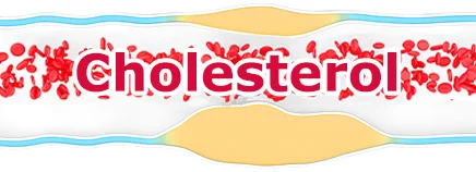 T-cholesterol-enHD-AR1.jpg