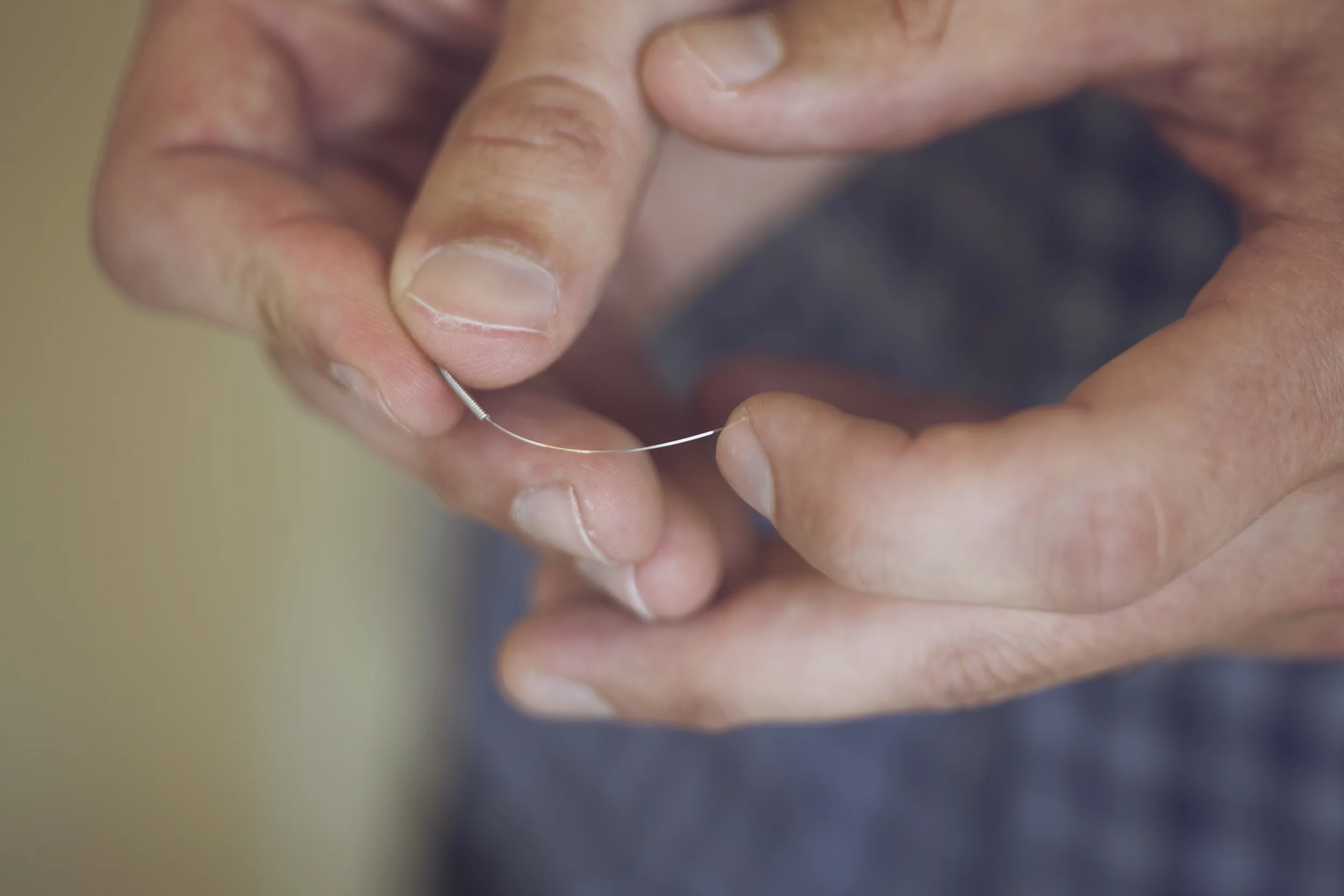 Acupuncture Oceanside