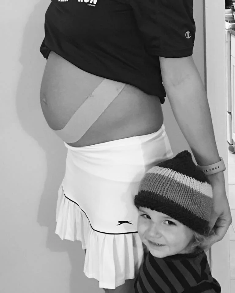 Dr. Erica, at 32 weeks, used a simple belly taping to help relieve pressure off the pubic symphysis. 