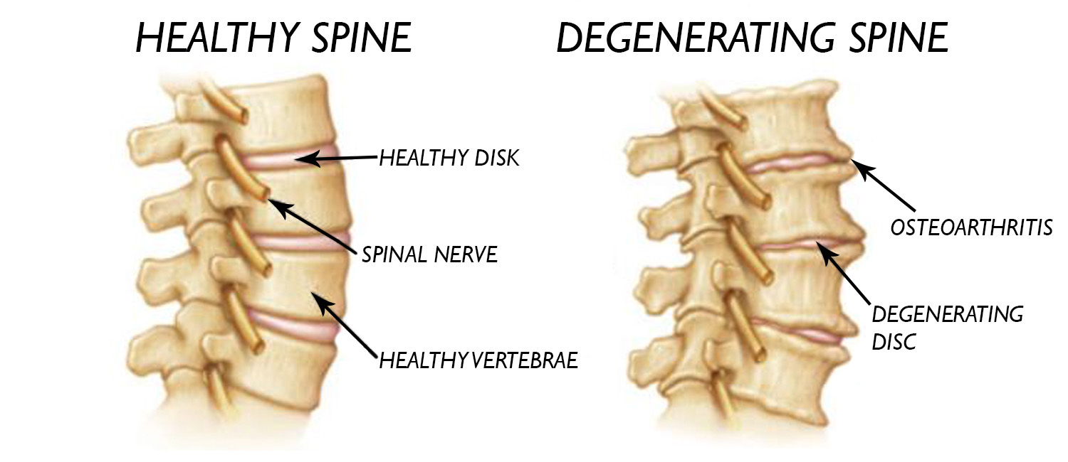All the nerves in your body come from the skull and spine. It is important to keep it healthy.