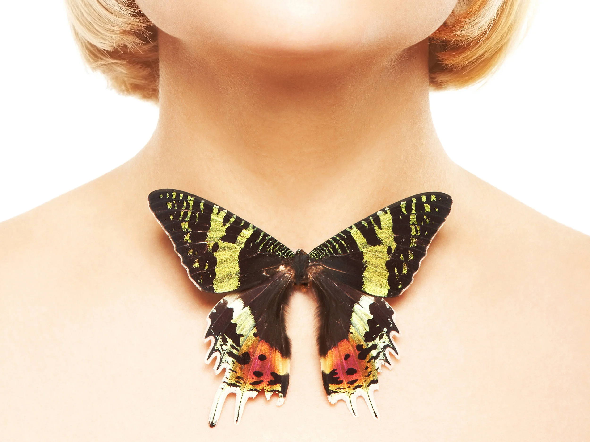 thyroidbutterfly.jpg