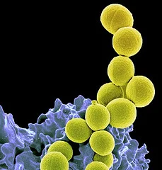 Methicillin-resistant Staphylococcus aureus Bacteria MRSA (yellow) being ingested by neutrophil (purplish blue). Credit: NIAID