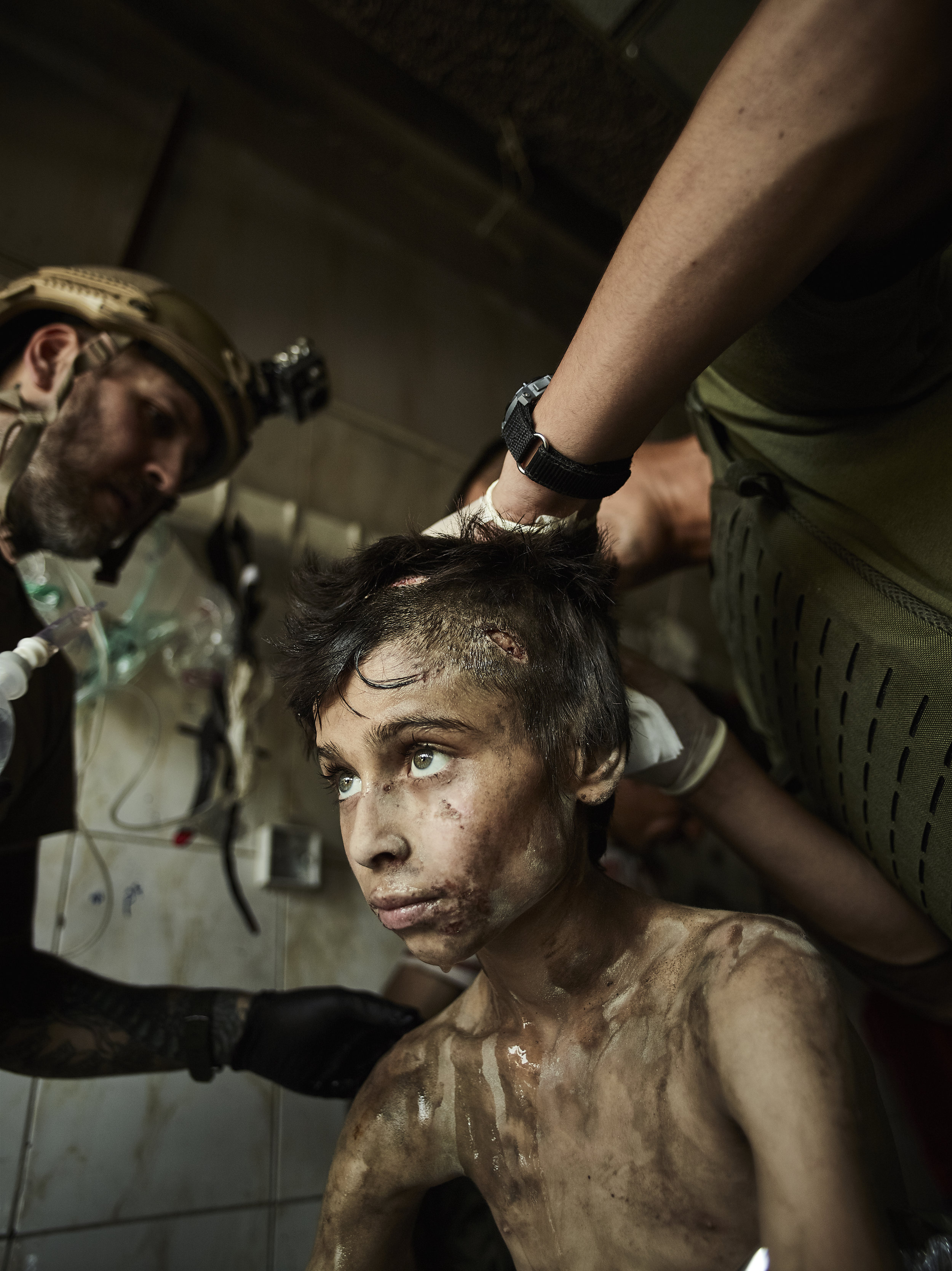 Tomas, a Yazidi boy who was kidnapped by ISIS, is given medical care in a field hospital, West Mosul