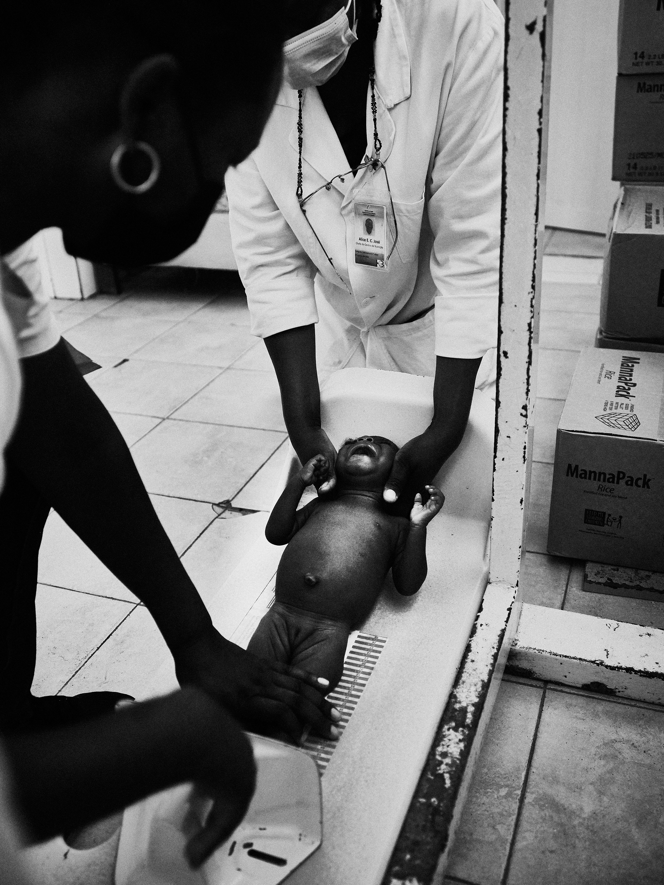 A malnourished child is measured for growth development, Angola