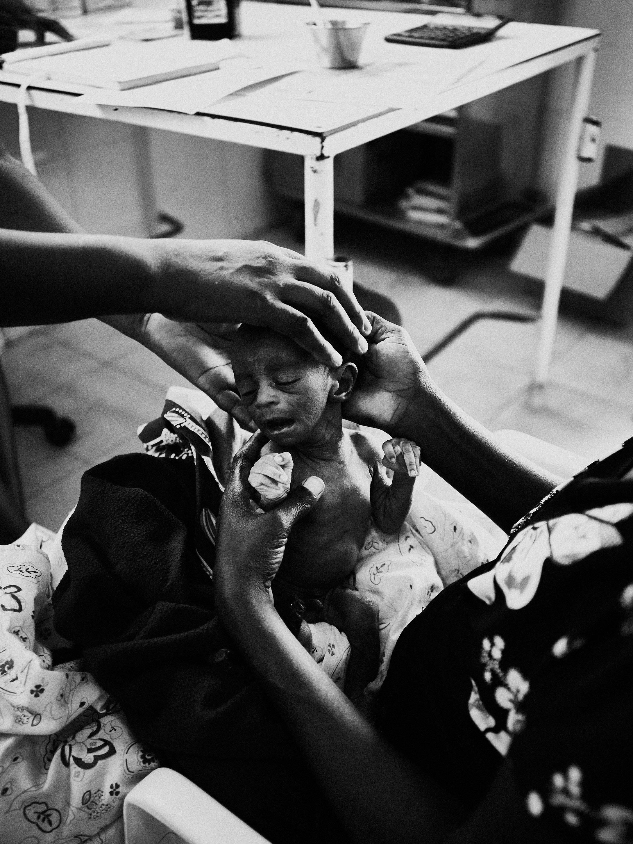 A malnourished child is comforted in a clinic in Luanda, Angola