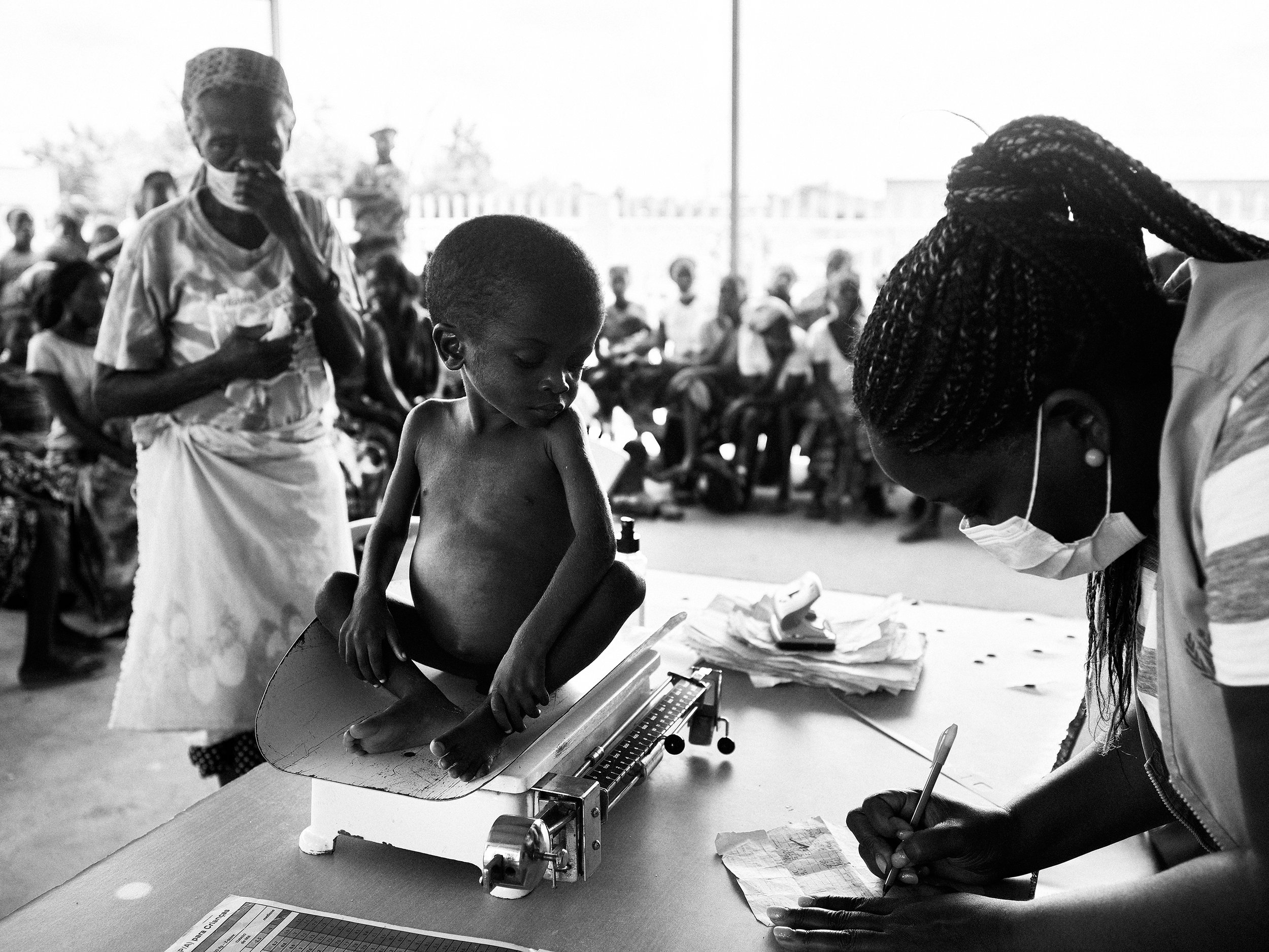 A malnourished child is weighed at a WFP clinic, Angola