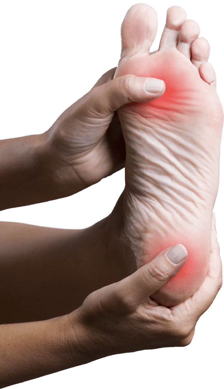 Neuropathy-foot.jpg