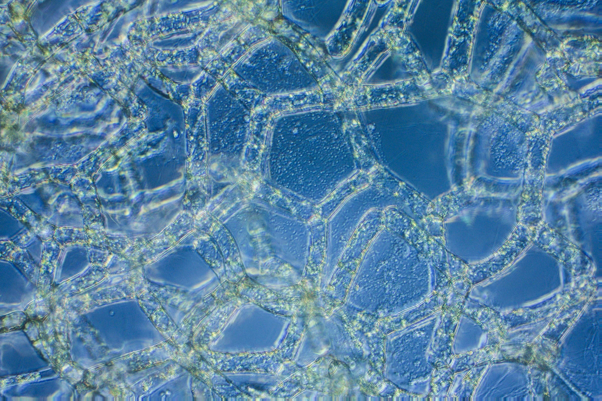 2017-04-14 14-08-41 (B,Radius50,Smoothing7).JPG