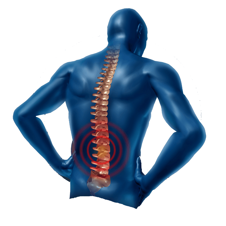 Back-Pain-Transparent-PNG (1).png