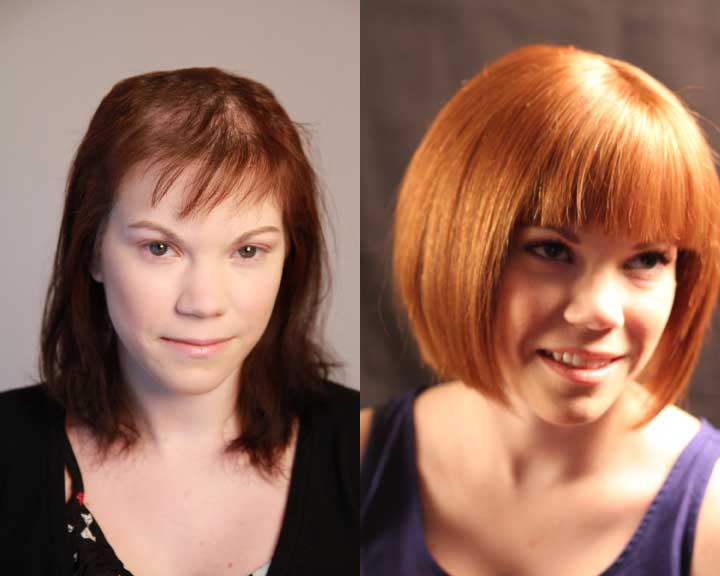   kim's dramatic hair loss transformation  