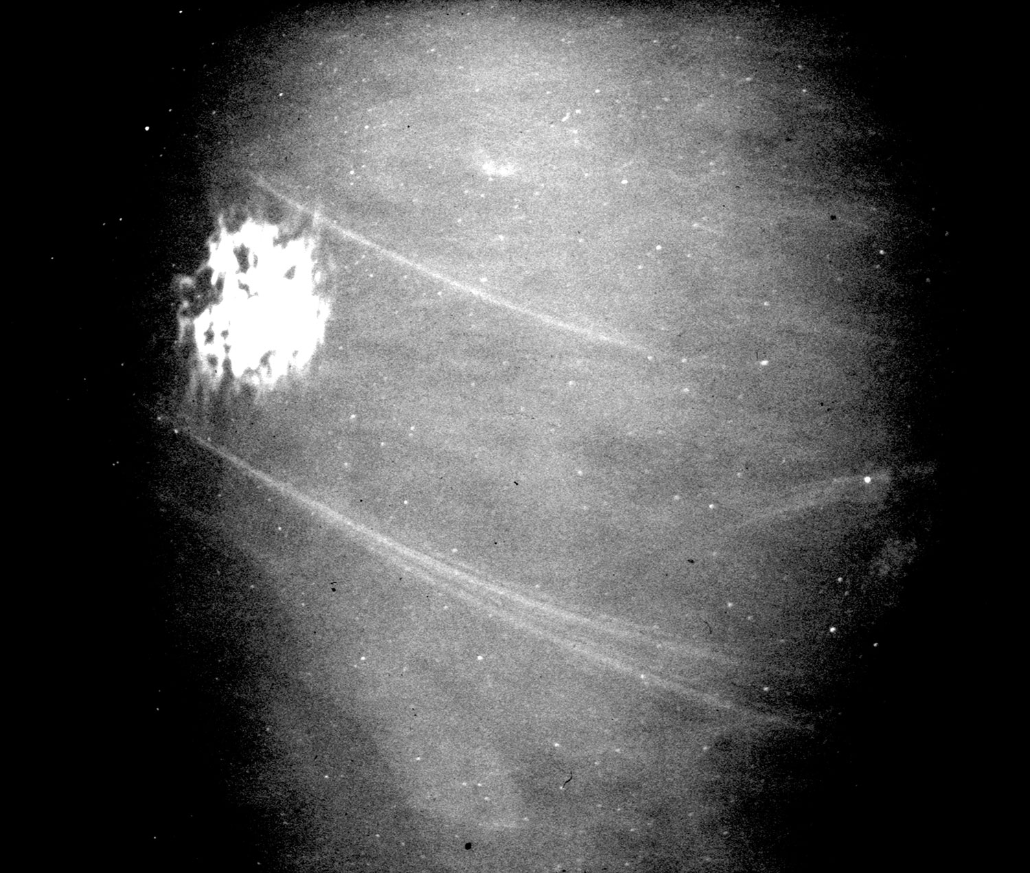 inner orbit
