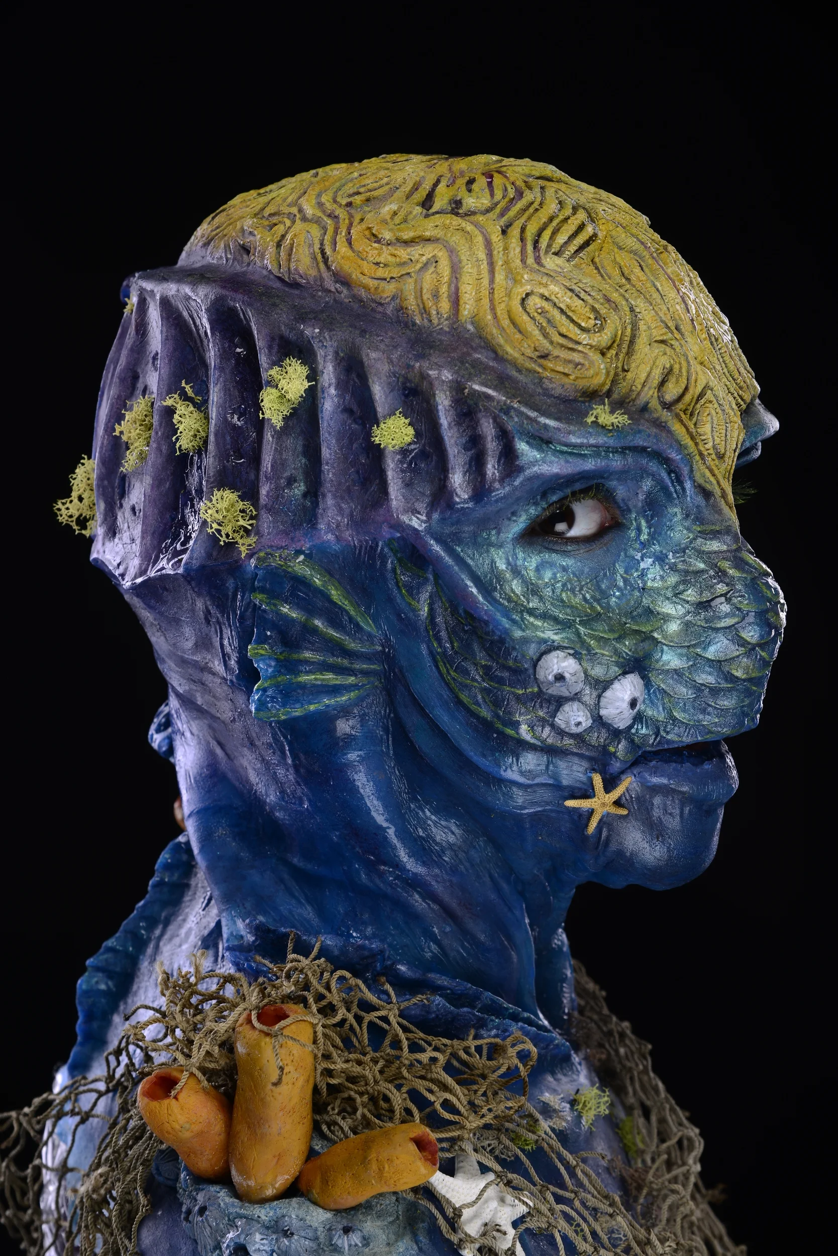 Custom silicone prosthetic