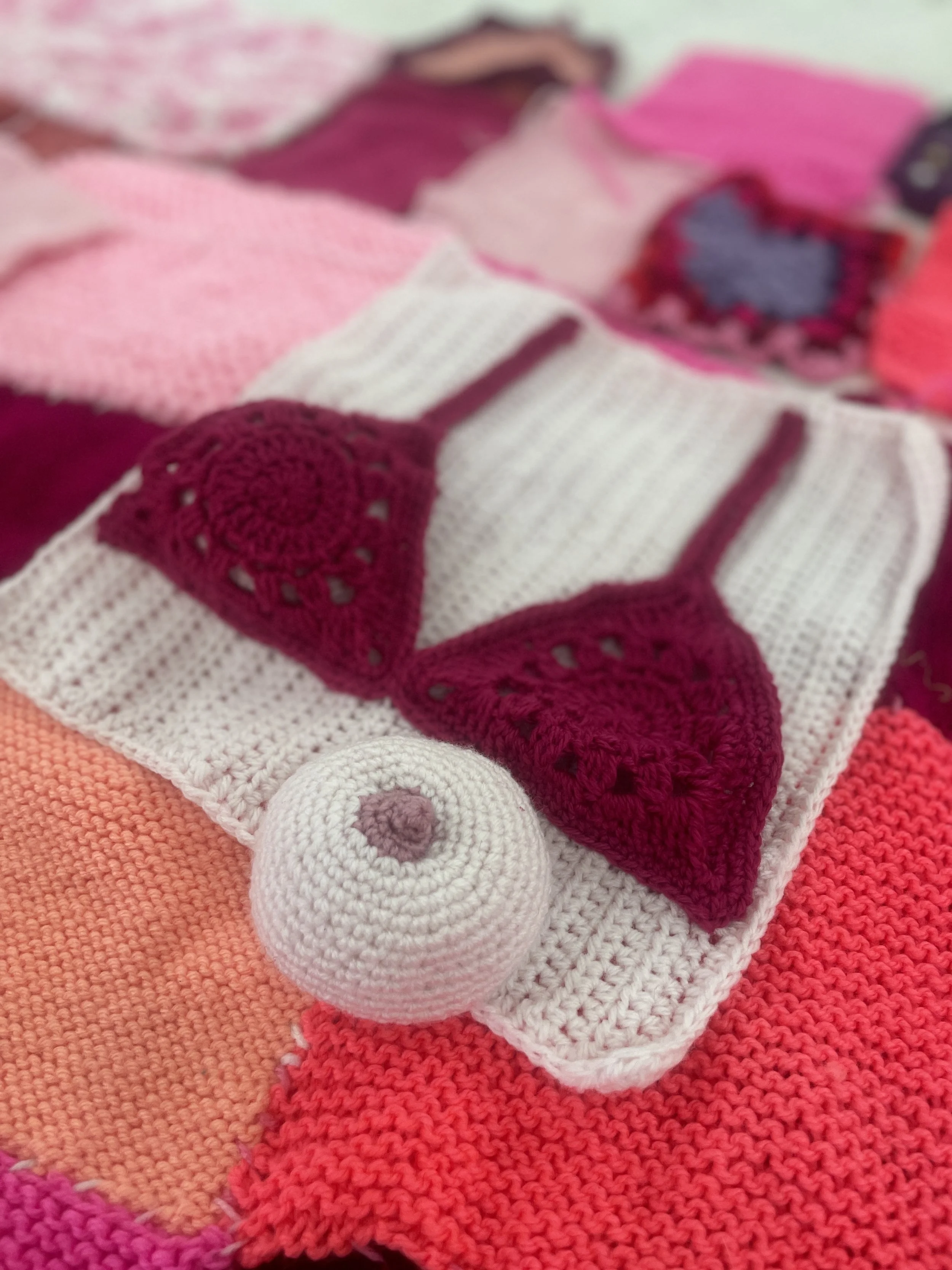 Breast Cancer -YBP-69.jpg