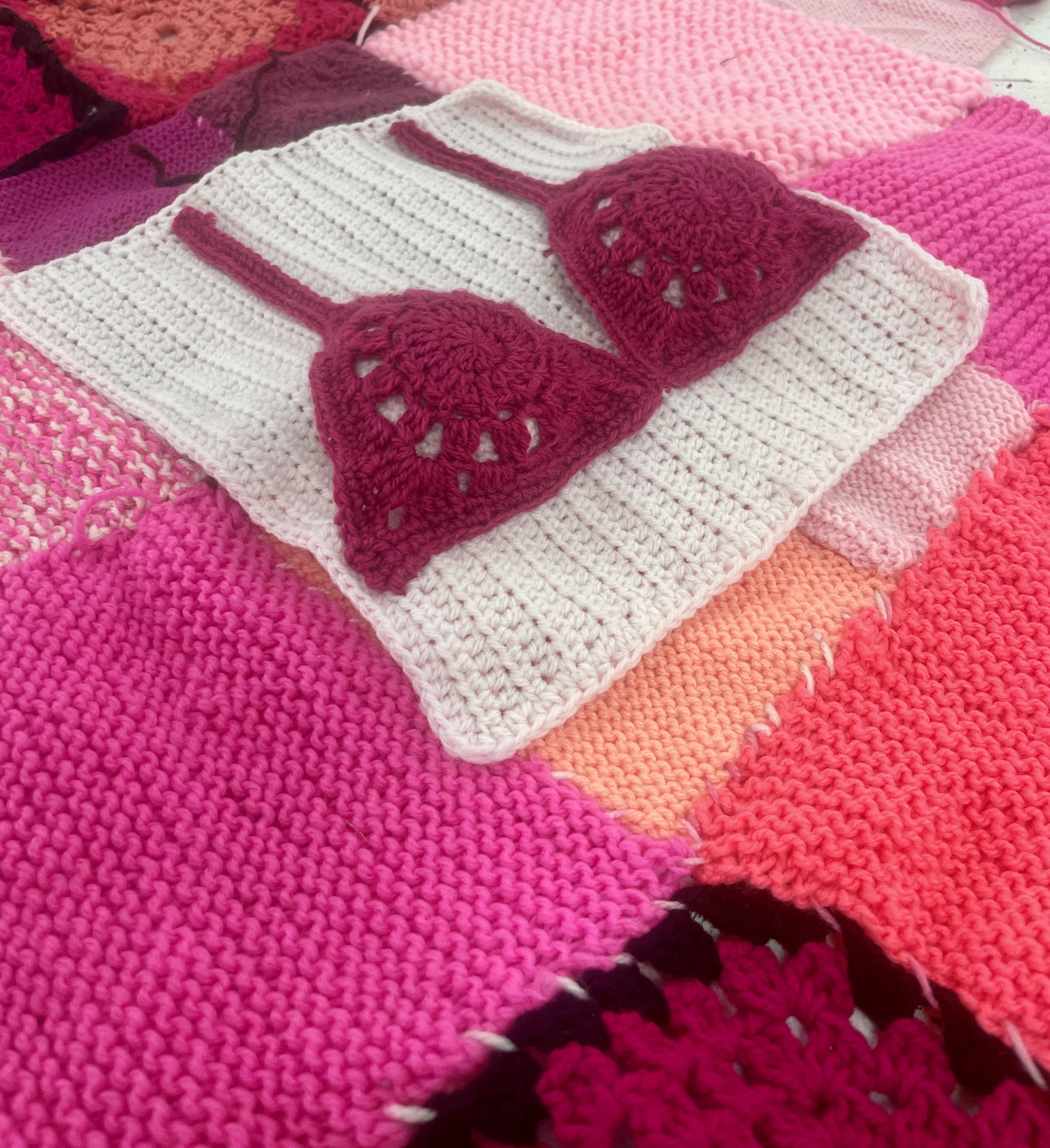 Breast Cancer -YBP-76.jpg