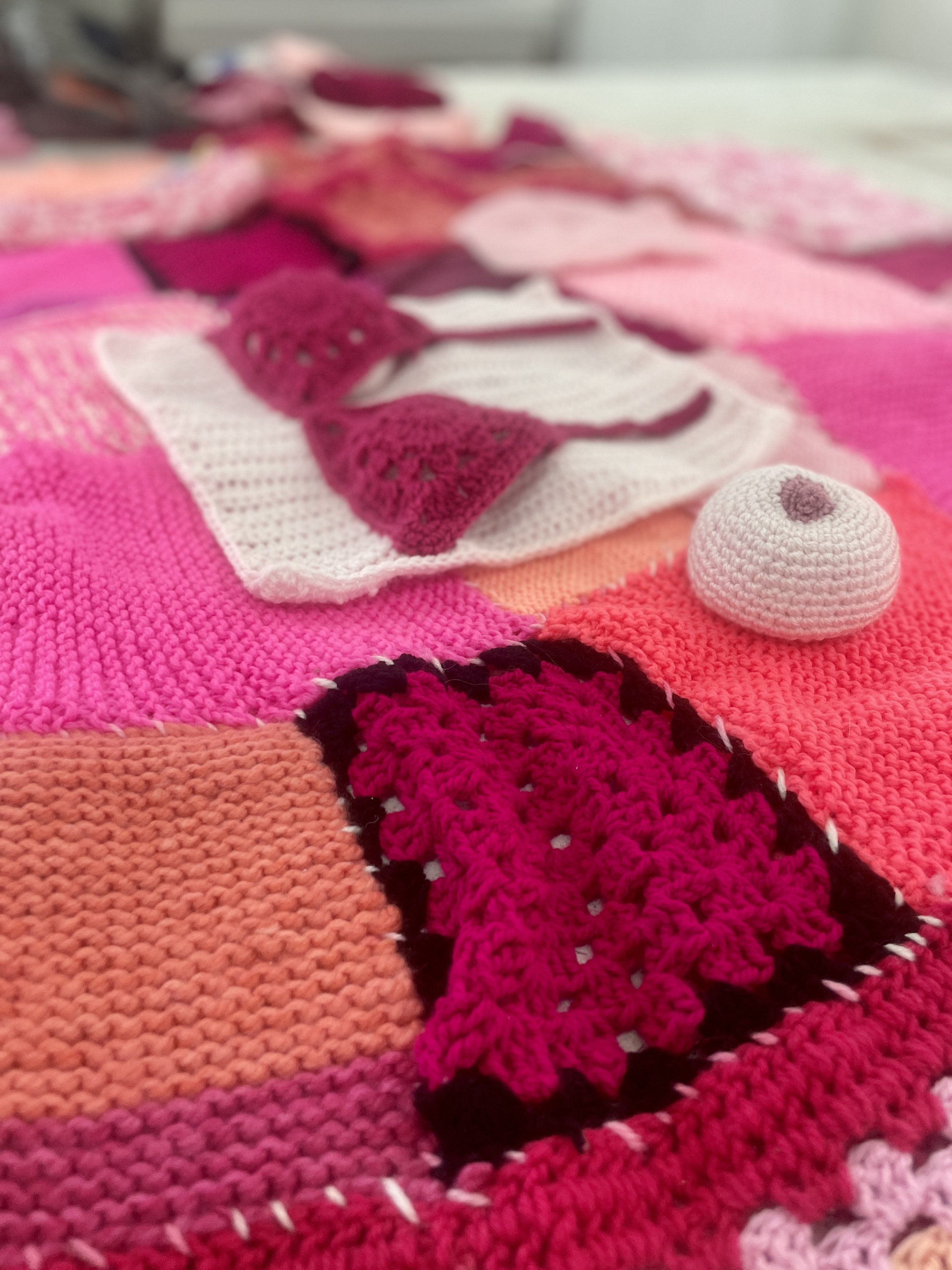 Breast Cancer -YBP-64.jpg