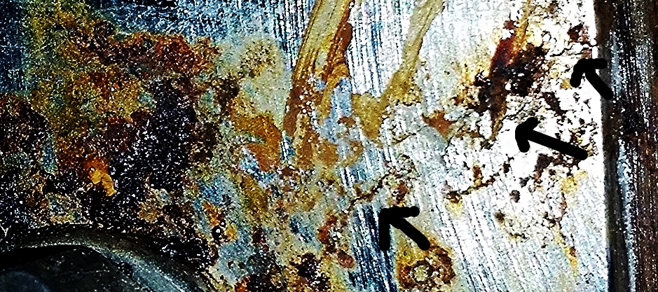 This is the same image but heavily zoomed and contrasted to accentuate the fracture line, along with some helpful arrows point to the crack. Can you see the crack line on the original image?
