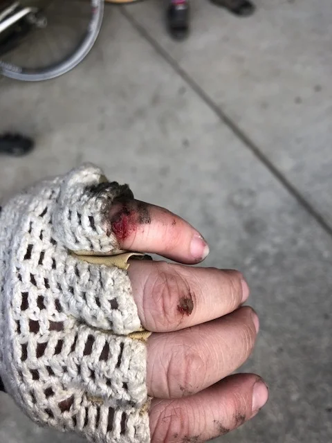 Maybe should've cleaned this wound a bit better
