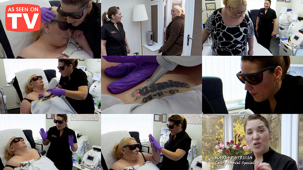 Laser Tattoo Removal Clinic Manchester - Maria Patricia - Laser Tattoo  Removal - Laser Hair Removal - Carbon Laser - Skin Rejuvenation - Dermal  Rollers