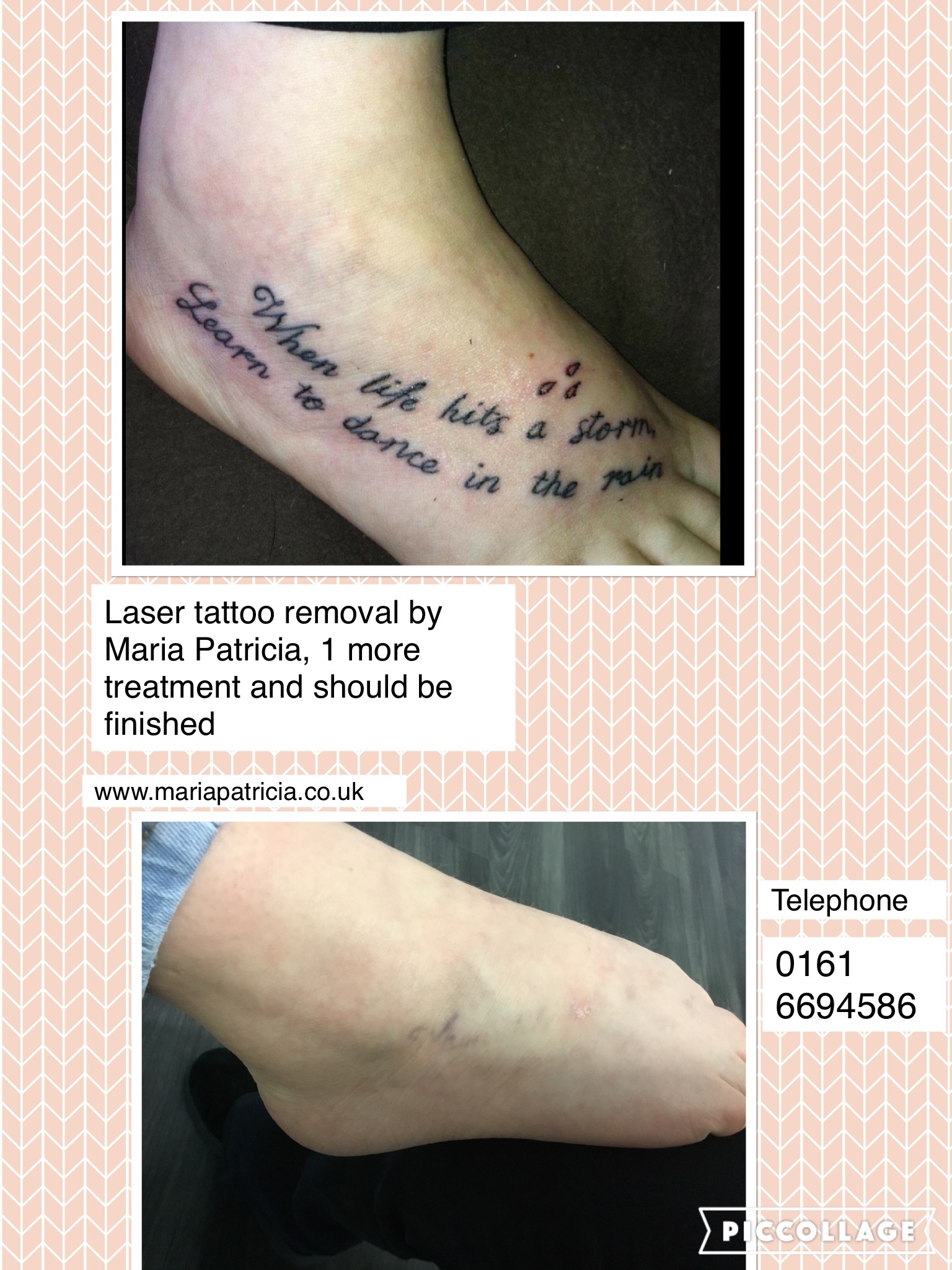 Latest before and after pictures of tattoo removal - Maria Patricia - Laser  Tattoo Removal - Laser Hair Removal - Carbon Laser - Skin Rejuvenation -  Dermal Rollers