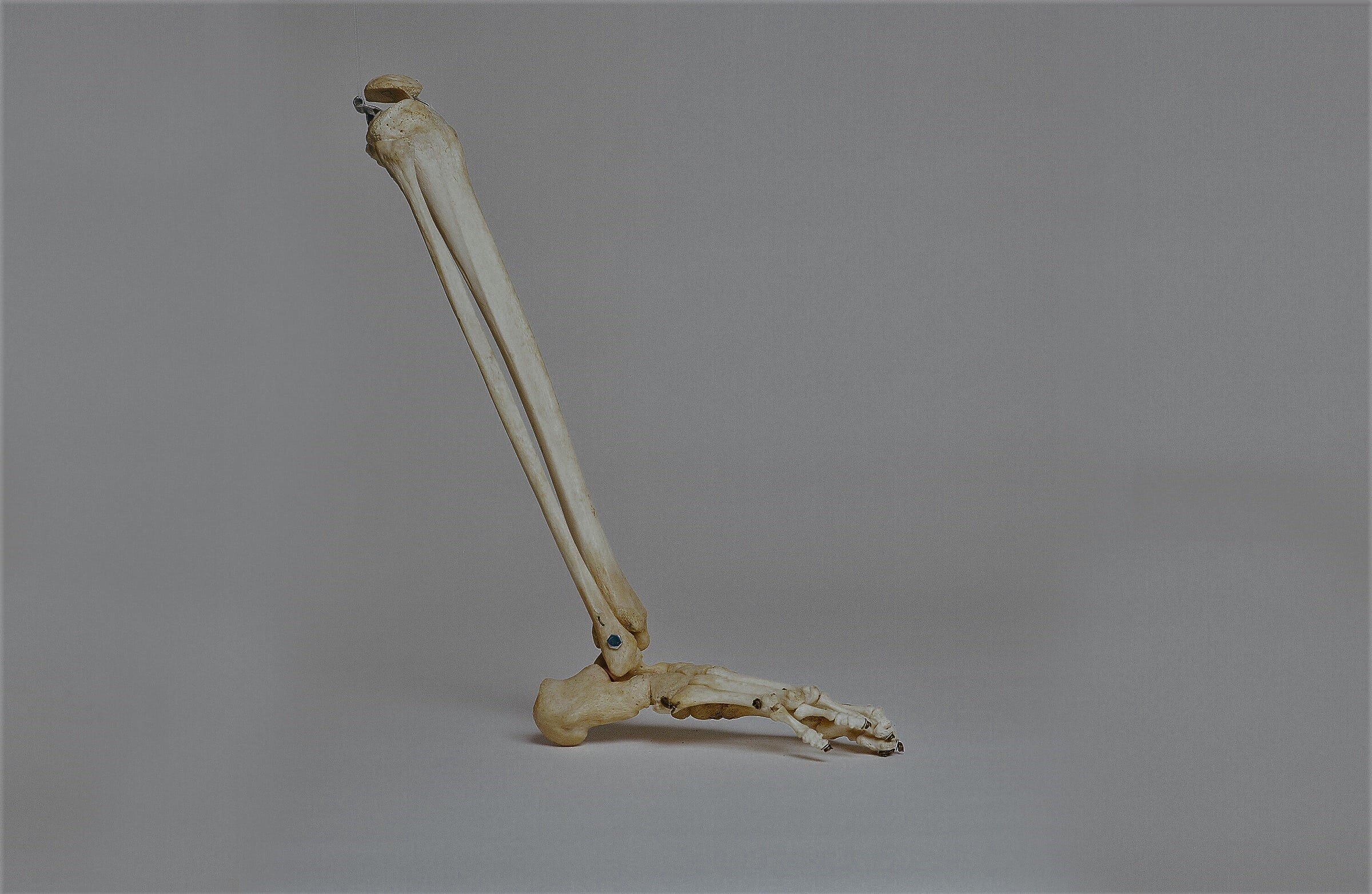 leg bone - title page .jpg