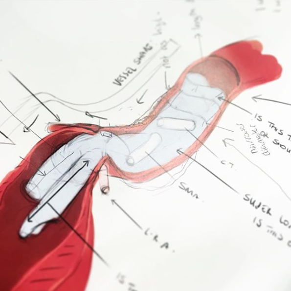 Campbell-Medical-Illustration-Work-in-progress-02.png