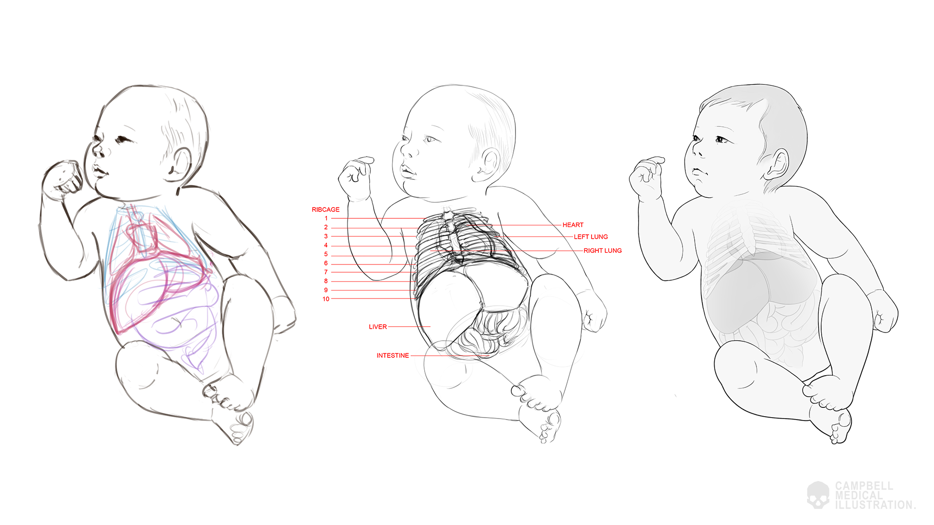 Susanna-Brighouse-Baby-medical-illustration-work-in-progress.png
