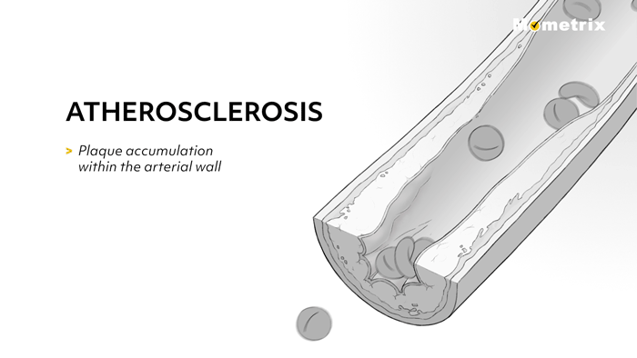 Campbell-Medical-Animation_illustration-animation-example-mometrix-01.gif