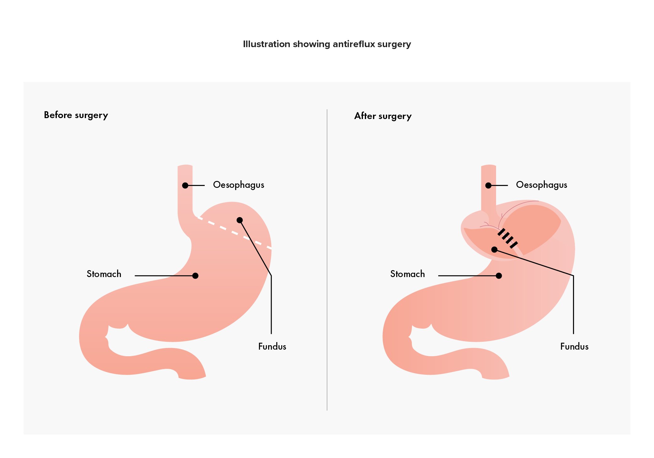 Ankur Patel Portfolio for web 2025_v129.jpg