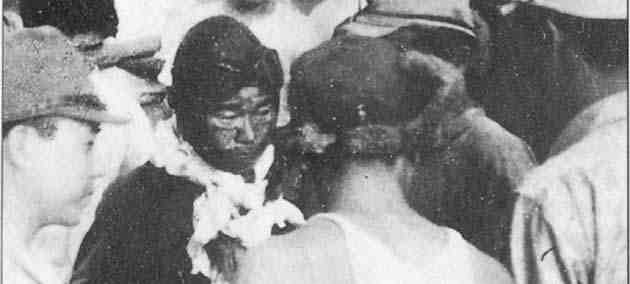The picture's kind of grainy, and he looks more dazed than anything here. But part of that is because he stopped some of the bleeding with his silk scarf earlier. Combat pilots are a practical type.