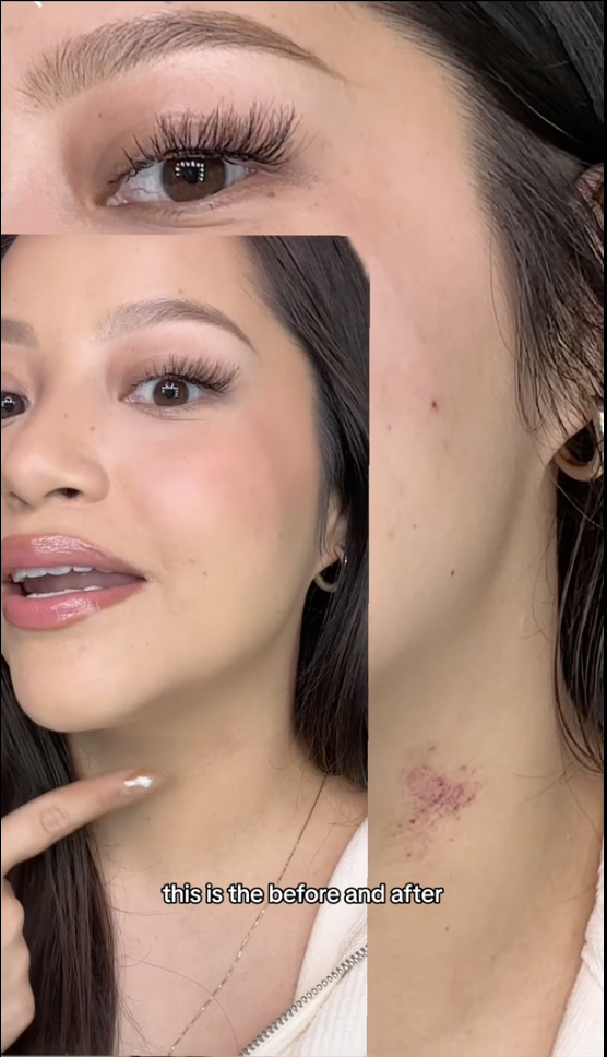 Jess Before and After.png