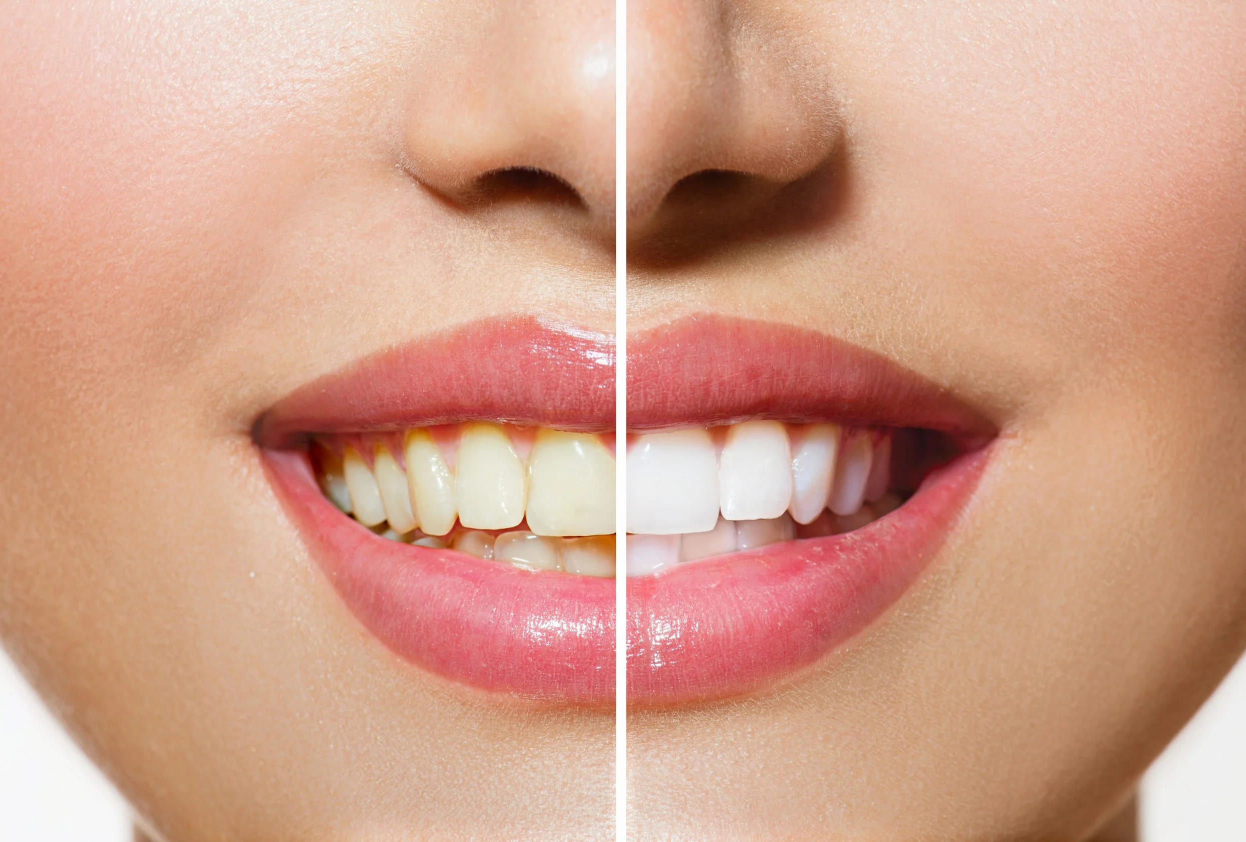 Whitening.jpg