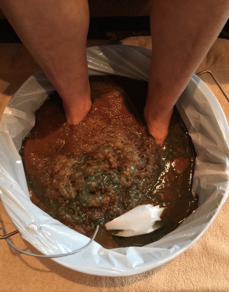 detox foot bath)