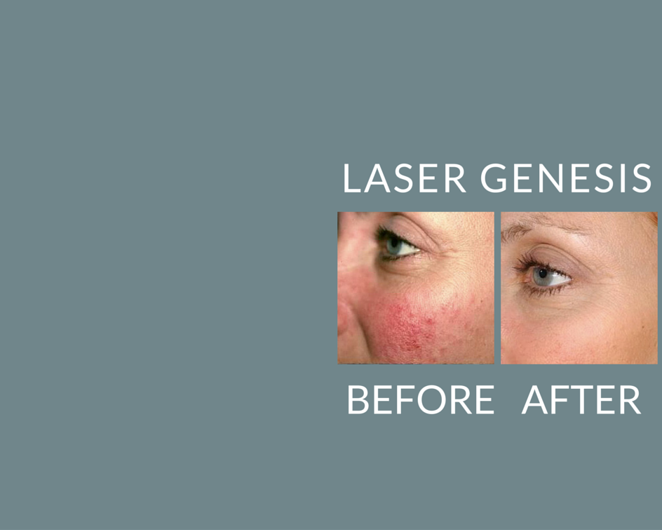 Lakes Dermatology Serving Burnsville &