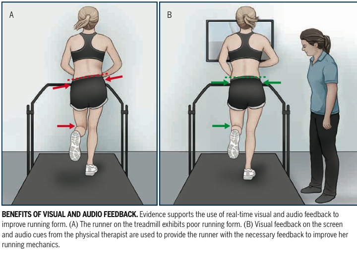 physical+therapy+feedback,+running+gait+retraining.jpeg