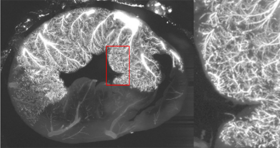 porcine coronary Vascular structure imaged with imaging cryomicrotome