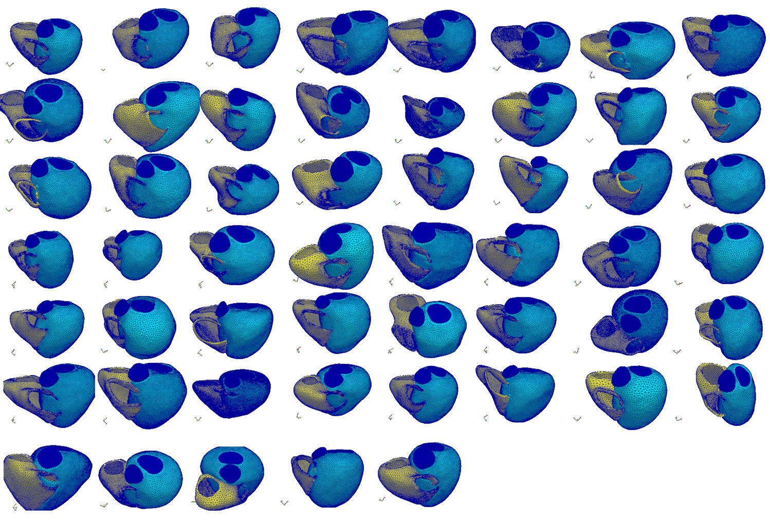TETRAHEDRAL BI-VENTRICULAR MESHES CREATED FOR 50 INDIVIDUAL PATIENTS WITH THE s2S sOFTWARE.