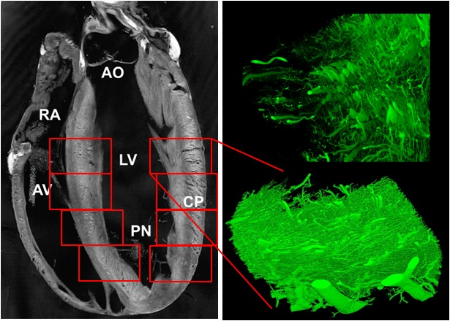Transmural coronary vascular network imaged by confocal microscopy at 1 micron resolution reveals regionally-varying orientation of the microvessels. macroscopic hemodynamic parameters are derived by volume averaging of the image data.