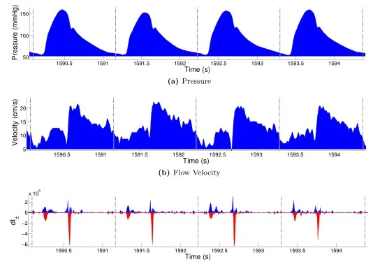  beat-wise coronary wave intensity analysis is enabled by the use of adaptive savitzky-golay filter as a pre-processor