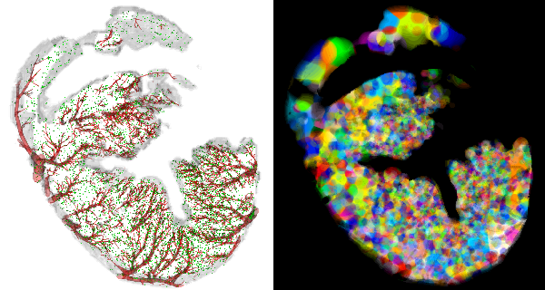  CORONARY TERRITORIES SHOWN ALONGSIDE THE VASCULAR NETWORK THAT SUPPLIES THE FLOW 
