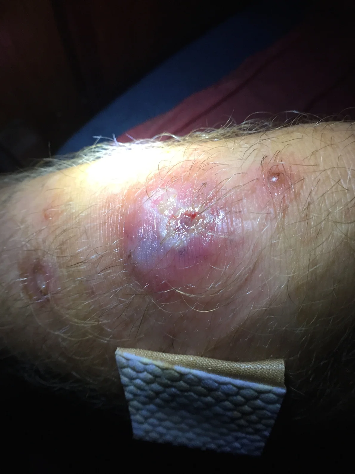 It got a whole lot worse looking....