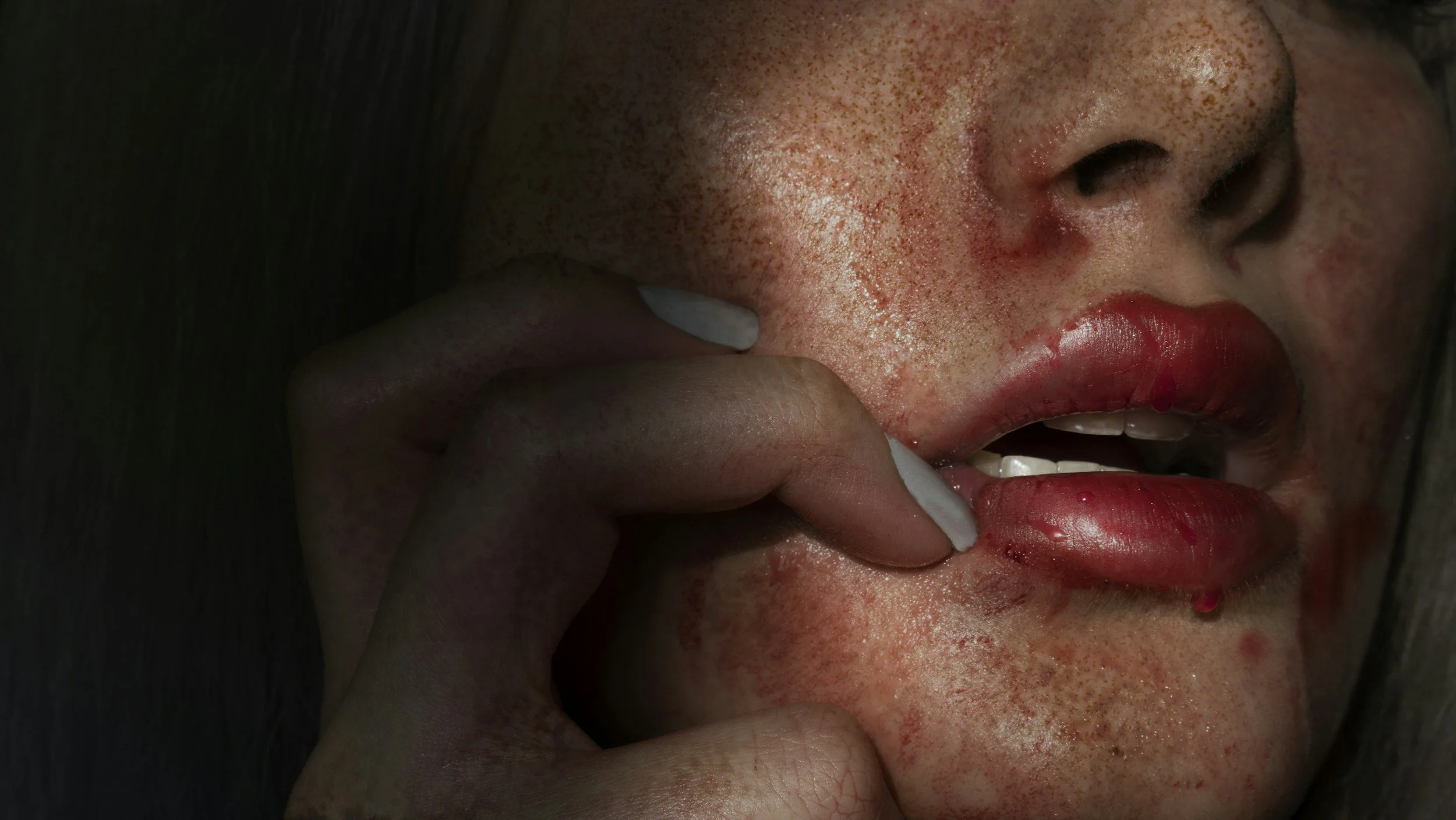 Why Your Skin Probably Isn’t a Skin Problem