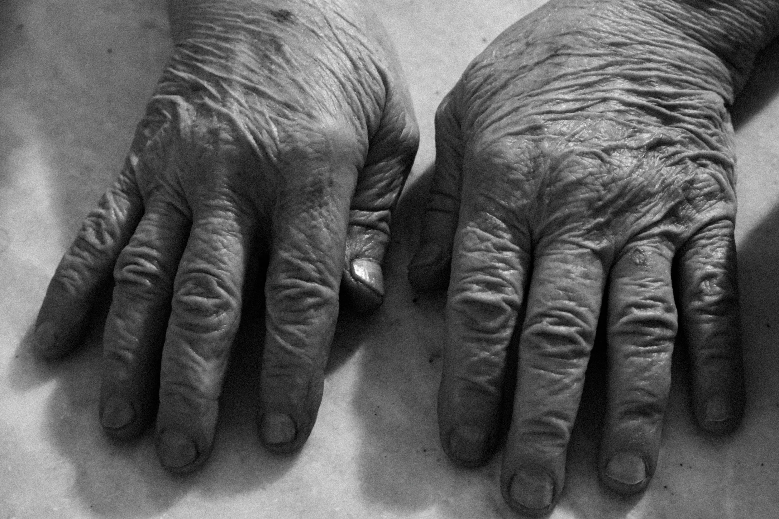 The longevity consultation - what to expect and how to prepare
