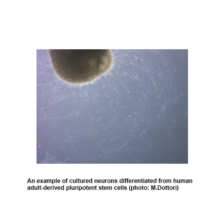 brain organoid.jpg