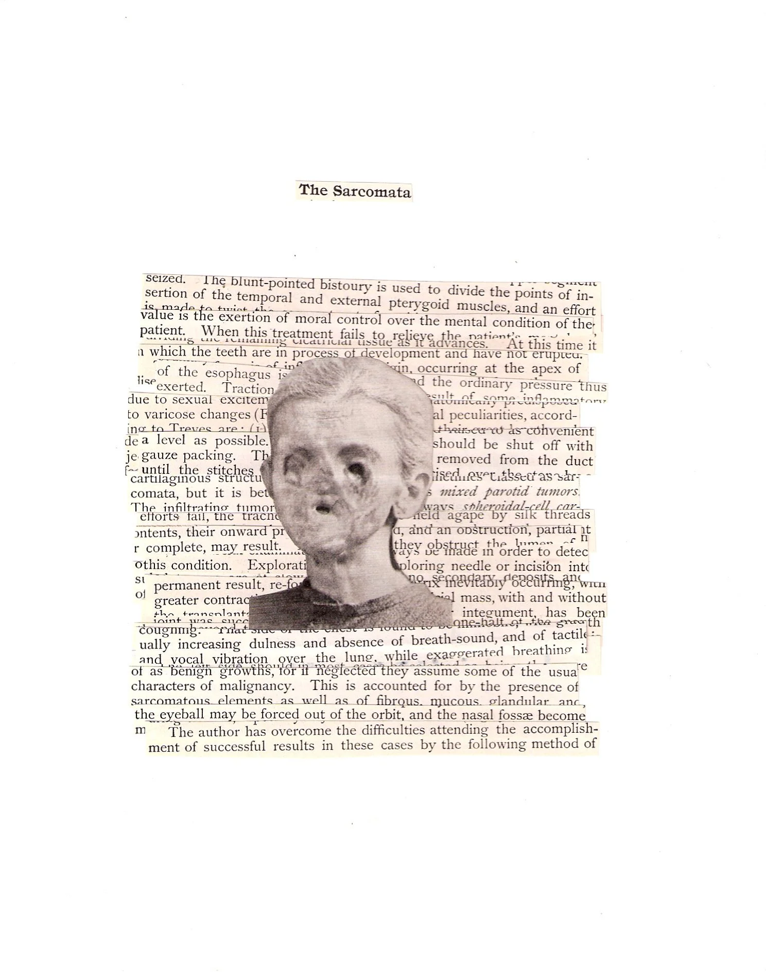  The Sarcomata 